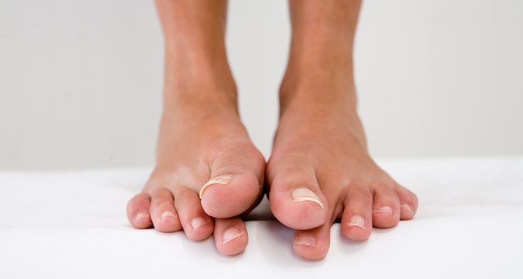 causes-of-numb-toes