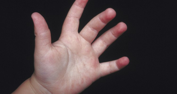 El aleteo de las manos es un comportamiento autoestimulante natural.