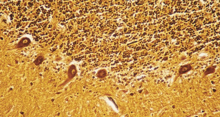 Imagen del tejido cerebral vista al microscopio.