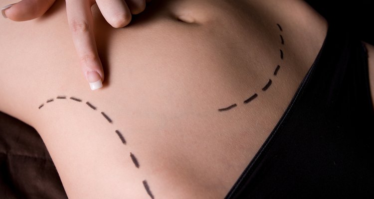 O seroma não só retarda a cicatrização das feridas, mas pode levar a infecções e à necrose do tecido, se não tratado