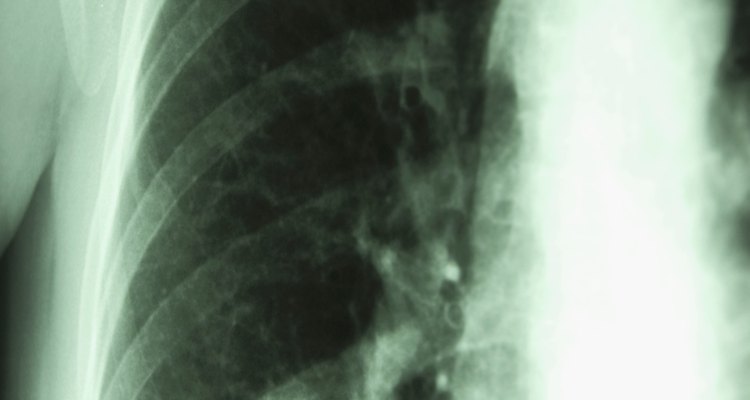Ventilation is the goal of breathing.