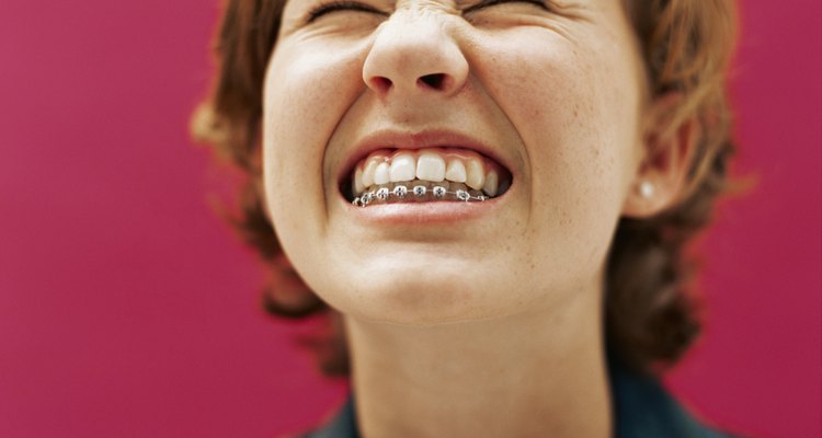 Dental responsibilities remain even after braces come off.