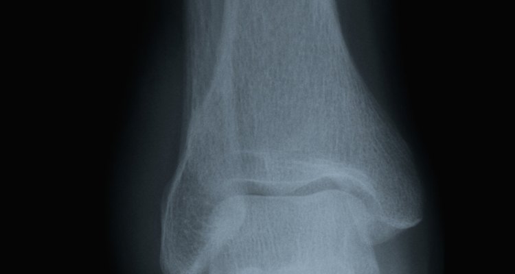 As palmilhas ortopédicas ajudam no conforto dos pés e ajuste da postura
