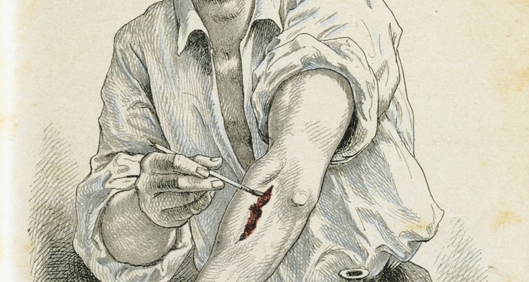 Nossa pele e quaisquer feridas precisam de cuidados especiais para evitar infecções