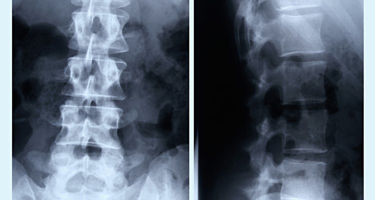Como fazer um modelo da coluna vertebral humana