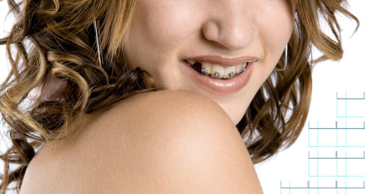 Having braces shouldn't discourage you from attending prom.