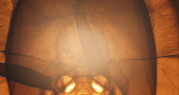 Conenoses are parasites