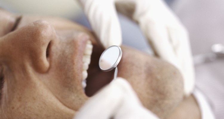 Alveolite pode ocorrer depois de uma extração dentária
