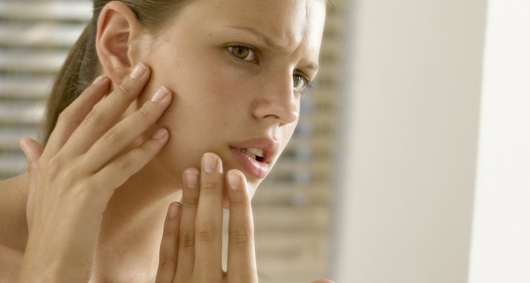 Sabonete Asepxia é uma ótima opção para tratar a acne, mas requer cuidados