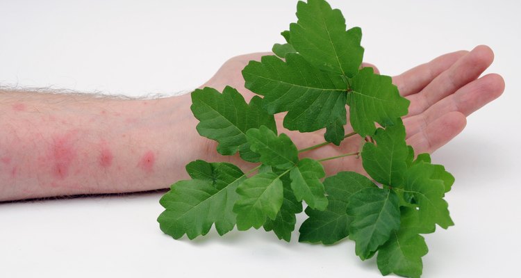 Poison oak causes a skin rash.