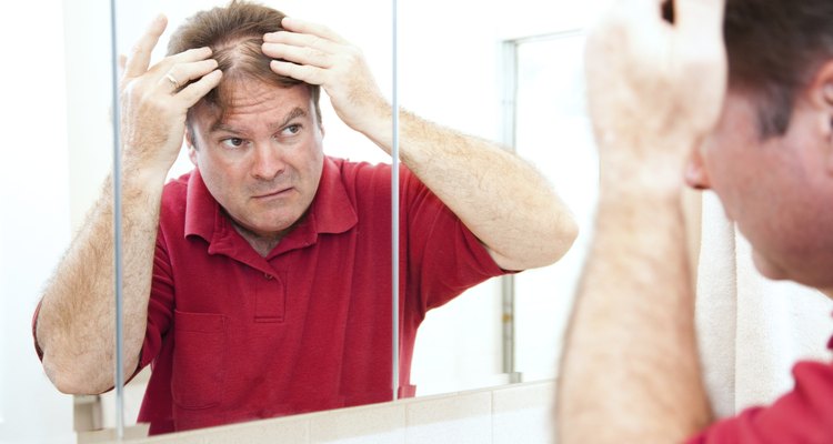 Thinning Hair in Middle Age