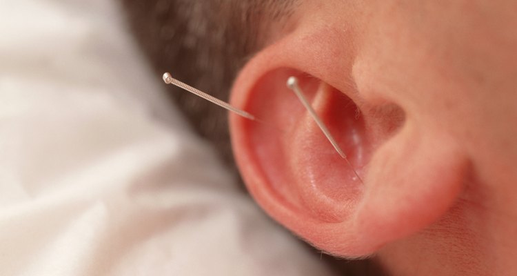 Existem alguns pontos na orelha que ajudam fumantes a largar o vício com ajuda da acupuntura