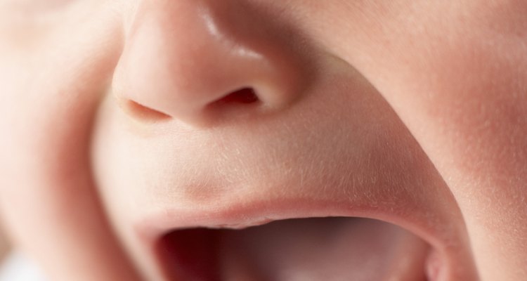 La dermatitis del pañal puede ser terriblemente incómoda para los bebés.