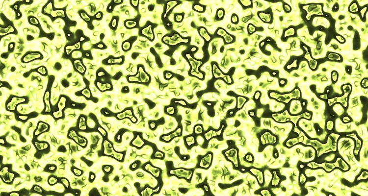 Vistos al microscopio, los critales de estruvita (fosfato amónico magnésico) son como fragmentos de vidrio.