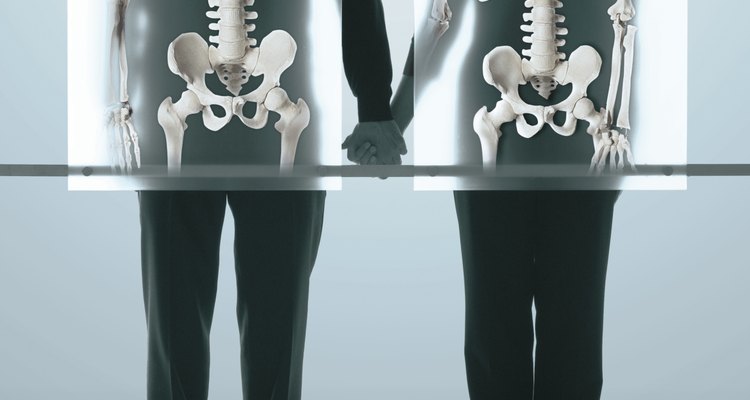 La osteoporosis juvenil generalmente está causada por la enfermedad subyacente.