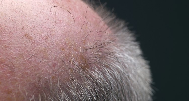 Macro shot of man's bald spot