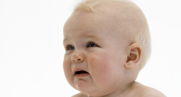 Mantén la cara de tu bebé seca para reducir la posibilidad de grietas e irritación.