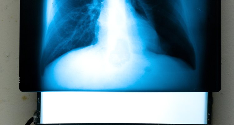 Los médicos usan imágenes de rayos X y de ultrasonido para diagnosticar y verificar la efectividad de los tratamientos.
