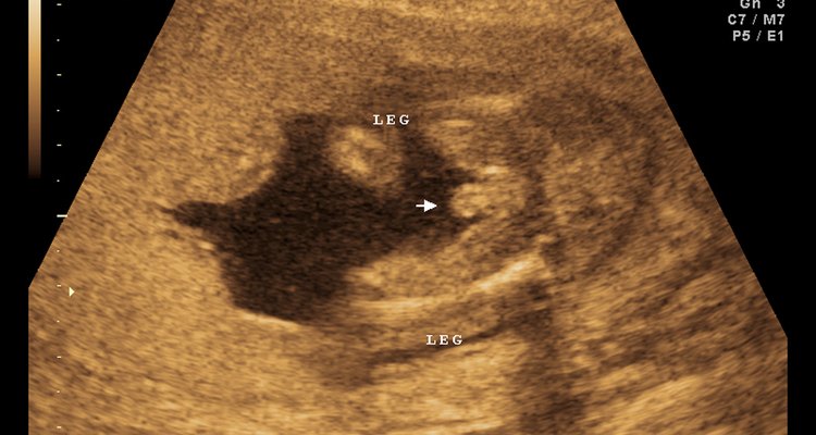 Um feto masculino mostra uma protusão entre as pernas