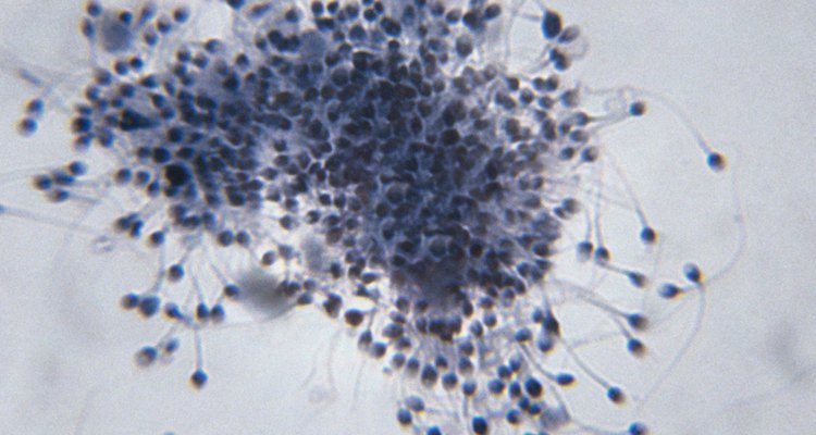 Imagem microscópica de espermatozoides humanos