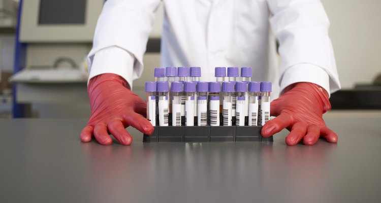 O clearance de creatinina pode ser feito com um teste de sangue