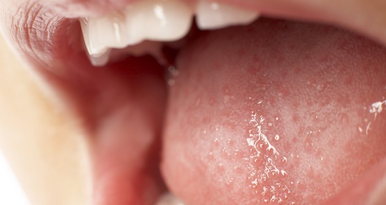 Los bultos dentro de tu boca pueden ser úlceras bucales, quistes mucosos, liquen plano oral o papilas inflamadas.