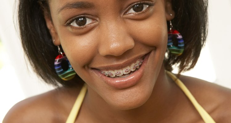 Escolha alimentos macios para evitar danos aos aparelhos e aos dentes
