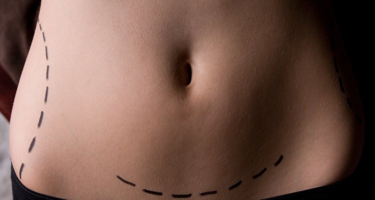 Belly button drawings are circular in shape.