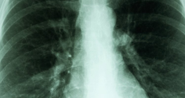 Os pulmões fornecem oxigênio para os demais órgãos vitais