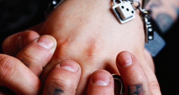 Trollbeads are commonly attached to charm bracelets.