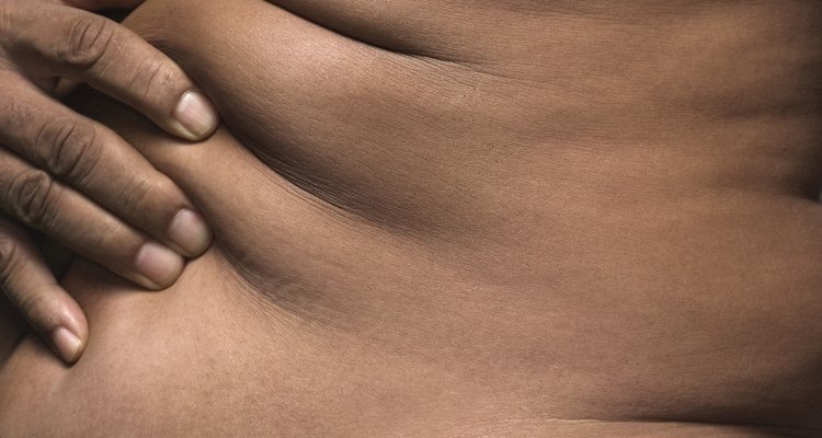 Treatment of intertrigo involves gentle, consistent care of your skin.