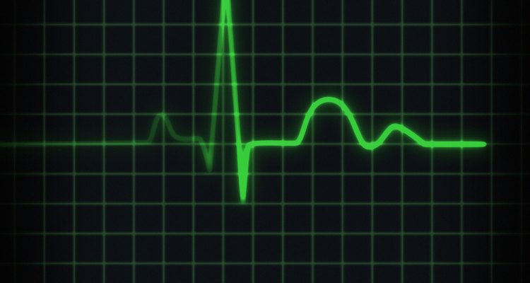 Frequência cardíaca representada na tela do monitor
