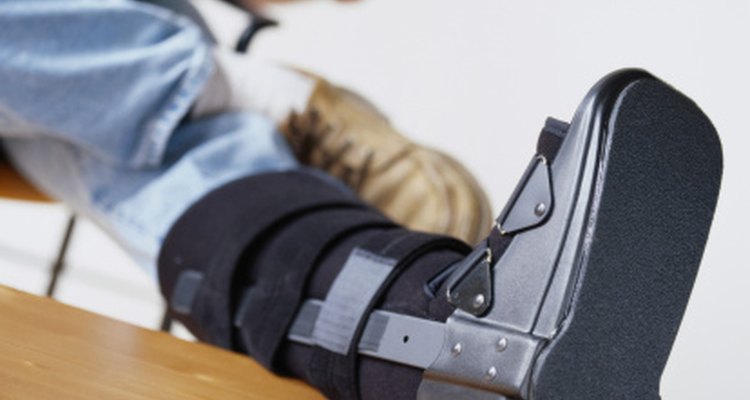 Puede que necesites usar una bota de caminar o yeso durante parte de tu rehabilitación.