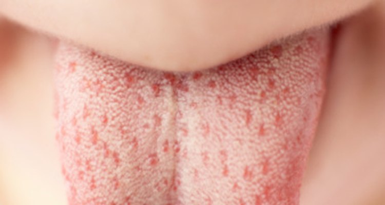 Revisar regularmente tu lengua para buscar bultos o inflamaciones inusuales debería ser parte de tu régimen de salud.