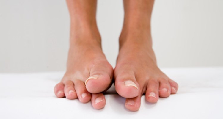 Las lesiones en el dedo gordo del pie pueden limitar el rango de movimiento.