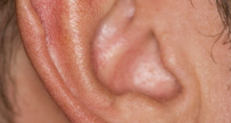 Una erupción tras las orejas puede ser eczema.
