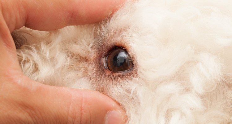 Examine seus olhos regularmente para ver se as cataratas estão progredindo