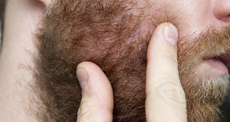 Arregla la barba para disimular las partes calvas.