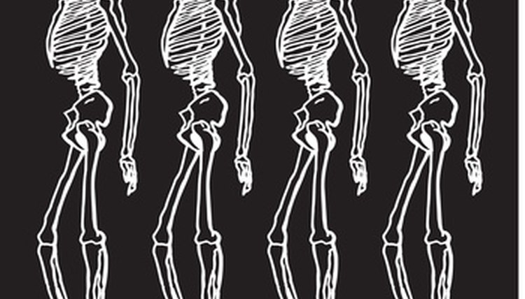 Surgical screws hold bones together.