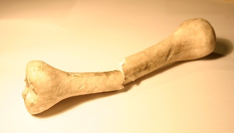 Cortical screws hold the outer bone tissue.