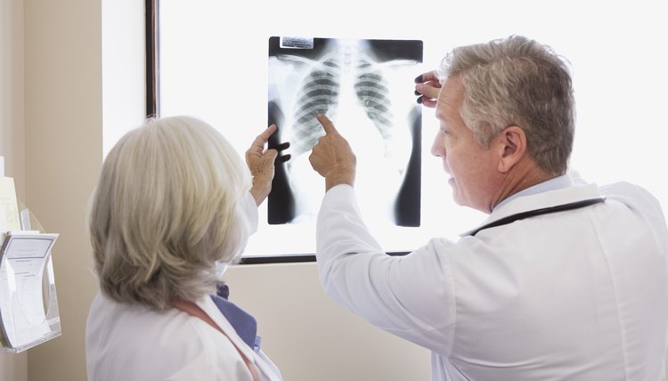 Doctors looking at chest x-ray