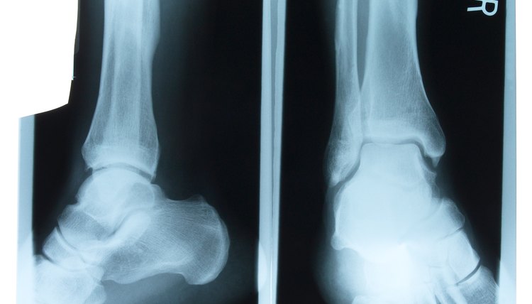 X-rays of human foot and leg