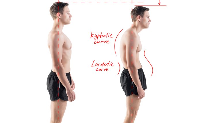Man with impaired posture position defect scoliosis and ideal bearing.