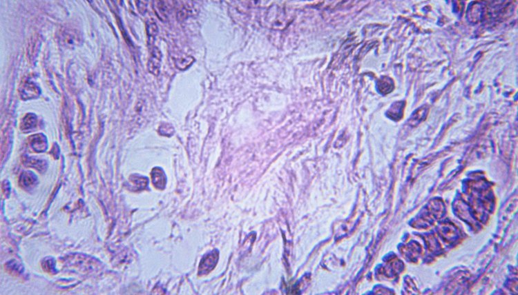 Flawed mitosis leads to the production of abnormal cells.