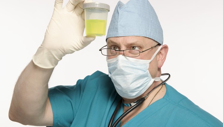 Random drug testing is usually done through urinalysis