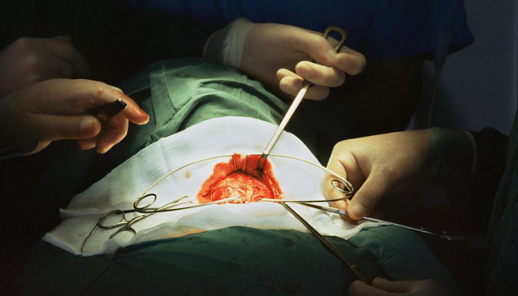 Removal of the thyroid gland requires life-long thyroid hormone replacement therapy.