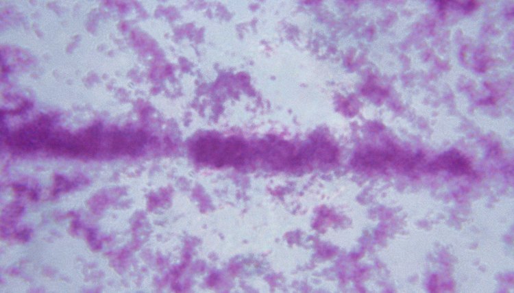 Microbes like tuberculosis cause the diseases that microbiologists seek to cure.