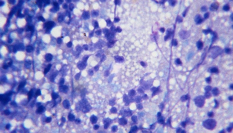 Light microscopy provides insufficient information about cell membranes.