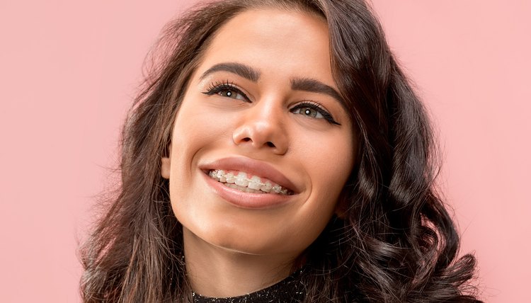 Mujer luciendo sus brackets en USA.