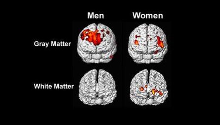 Brain activity also differs between men and women